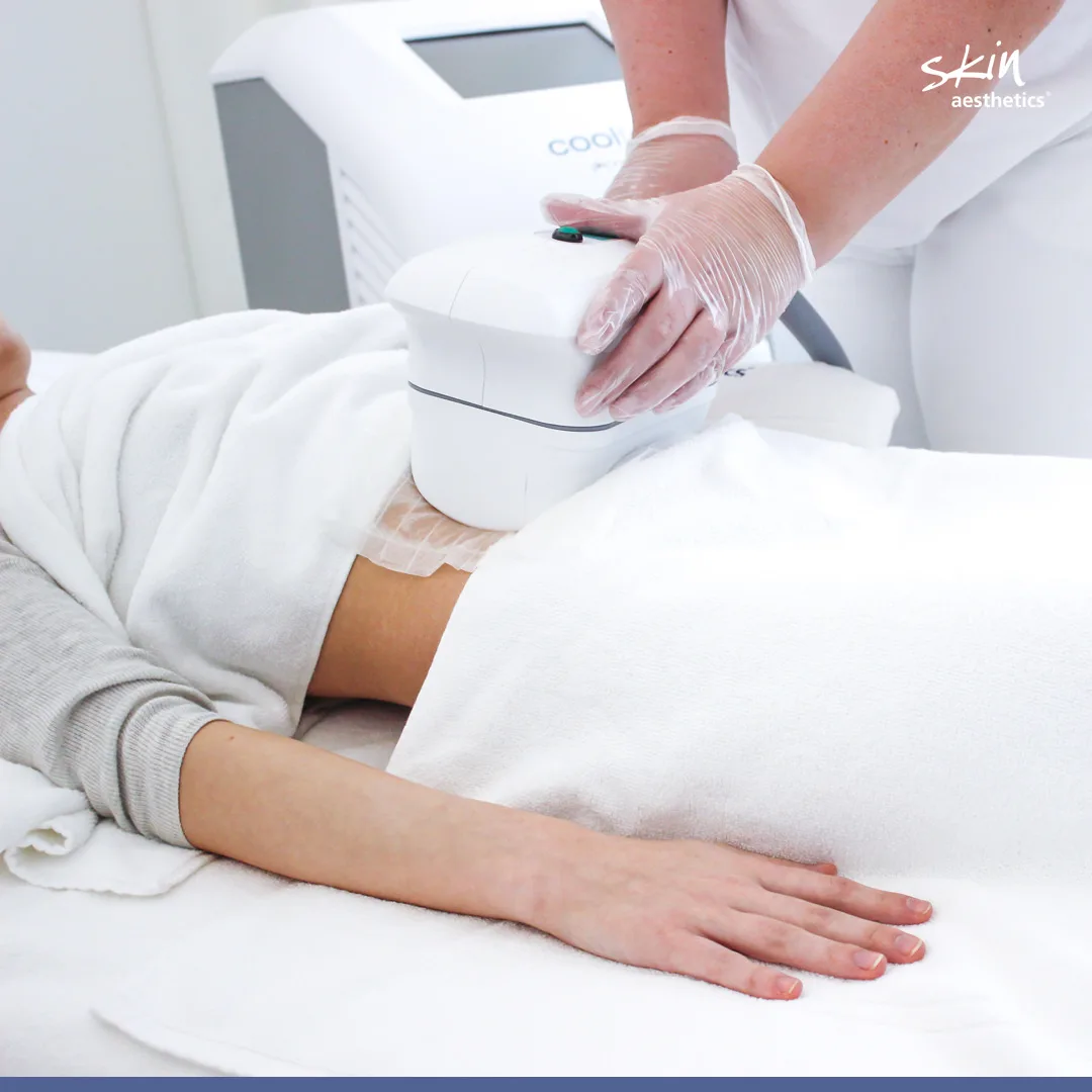 Funktionsweise der Kryolipolyse bei Skin Aesthetics